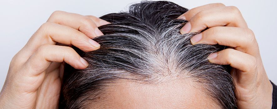 Saiba como prevenir cabelo branco - Fármacia Vida Natural